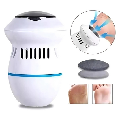 🥇 SOFTFEET™ – CUIDADO PROFESIONAL PARA PIES EN CASA
