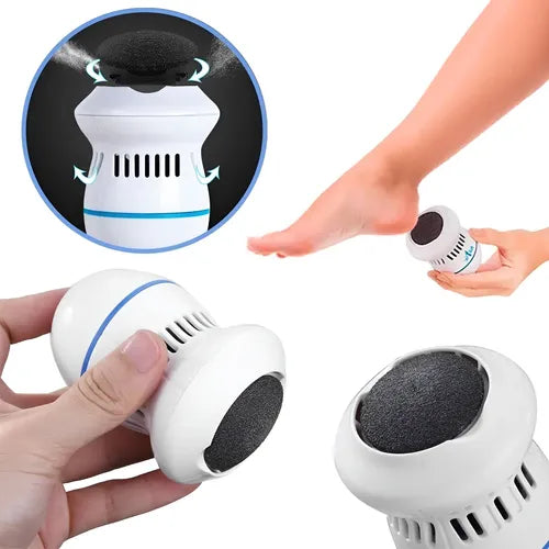 🥇 SOFTFEET™ – CUIDADO PROFESIONAL PARA PIES EN CASA