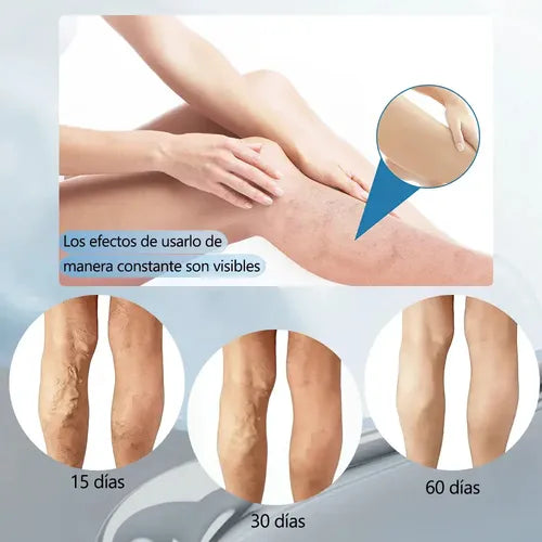 🥇 VARICARE™ – KIT COMPLETO PARA CUIDADO DE PIERNAS