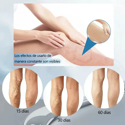 🥇 VARICARE™ – KIT COMPLETO PARA CUIDADO DE PIERNAS